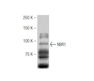 NBR1 Antibody (4BR) | SCBT - Santa Cruz Biotechnology