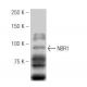 NBR1 Antibody (4BR) - Western Blotting - Image 53871