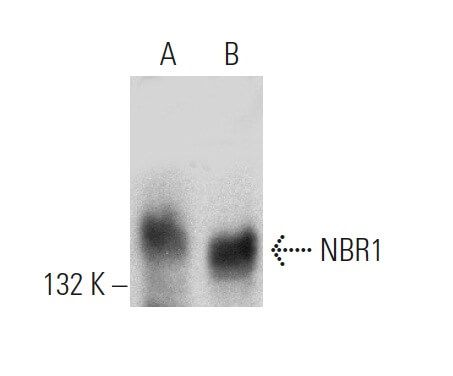 NBR1抗体(4BR) | SCBT - Santa Cruz Biotechnology