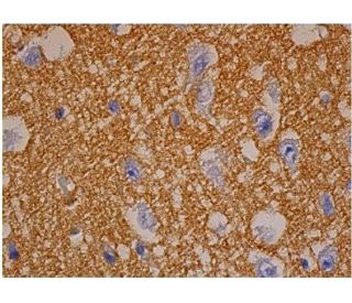 NCAM/CD56 Antibody (123C3) | SCBT - Santa Cruz Biotechnology