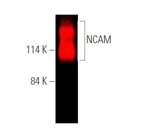 ご注文分 NCAM/CD56 Antibody (123C3) | SCBT - Santa Cruz Biotechnology