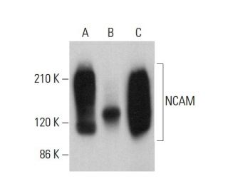 NCAM/CD56 Antibody (D-10) - Western Blotting - Image 379897 