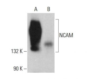 NCAM/CD56 Antibody (E-5) - Western Blotting - Image 379898 
