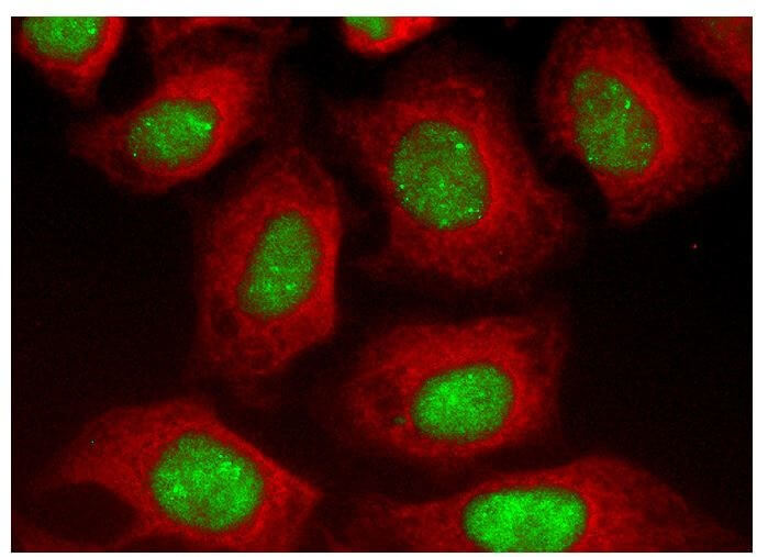 NCAM/CD56 Antibody (ERIC 1) | SCBT - Santa Cruz Biotechnology