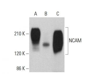 NCAM Antibody (ERIC 1) - Western Blotting - Image 379854 