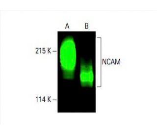 【一部予約！】 - SCBT | 1) (ERIC Antibody NCAM/CD56 Santa Biotechnology Cruz その他