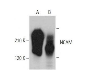 western blotting image from recommended NCAM/CD56 (123C3) monoclonal antibody replacement. Image 379848