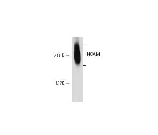 NCAM/CD56 Antibody (RNL-1) - Western Blotting - Image 12605