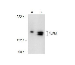 NCAM/CD56 Antibody (E-5) - Western Blotting - Image 147826