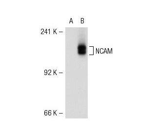 NCAM (CB56): sc-65896. Western blot analysis of NCAM expression in... 