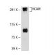 NCAM-L1 Antibody (2Q789) - Western Blotting - Image 32689 