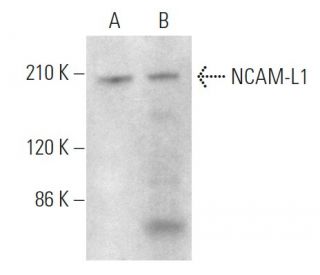 NCAM-L1 Antibody (5G3) - Western Blotting - Image 375060 