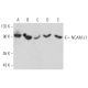 Este anticuerpo policlonal ha dejado de fabricarse. Consulta nuestro anticuerpo monoclonal recomendado <a href="ncam-l1-antibody-d-5">NCAM-L1 (D-5)</a> (se muestran datos de muestra). western blotting image from recommended NCAM-L1 (D-5) monoclonal antibody replacement. Image 358451