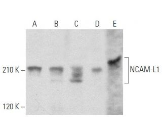 NCAM-L1 Antibody (UJ181.4) - Western Blotting - Image 358449 