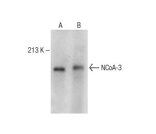 NCoA-3 Antibody (0.T.198) - Western Blotting - Image 149601