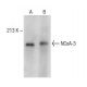 NCoA-3 Antibody (0.T.198) - Western Blotting - Image 149601
