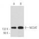 This polyclonal antibody has been discontinued. See our recommended <a href="ncoat-antibody-g-12">NCOAT (G-12)</a> monoclonal antibody (sample data shown). western blotting image from recommended NCOAT (G-12) monoclonal antibody replacement. Image 357464