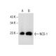 This polyclonal antibody has been discontinued. See our recommended <a href="ncs-1-antibody-g-4">NCS-1 (G-4)</a> monoclonal antibody (sample data shown). western blotting image from recommended NCS-1 (G-4) monoclonal antibody replacement. Image 154777