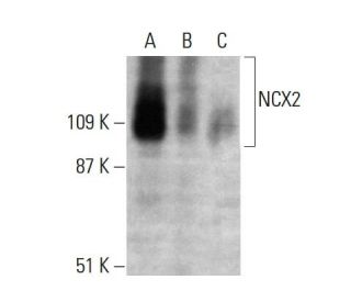 western blotting image from recommended NCX2 (E-1) monoclonal antibody replacement. Image 364778