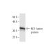 western blotting image from recommended ND1 (3H3) monoclonal antibody replacement. Image 348550