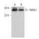 Ndfip1 Antibody (D-4) - Western Blotting - Image 382665