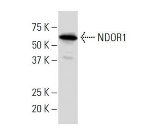 NDOR1 Antibody (XX-9) - Western Blotting - Image 33853