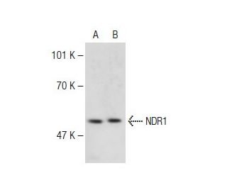 NDR1 Antibody (A-8) - Western Blotting - Image 148662 