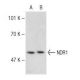 NDR1 Antibody (A-8) - Western Blotting - Image 148662 