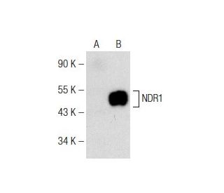 NDR1 Antibody (A-8) - Western Blotting - Image 142602