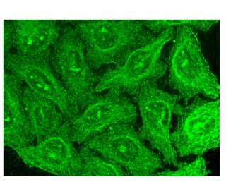NDRG1 Antibody (B-5) | SCBT - Santa Cruz Biotechnology