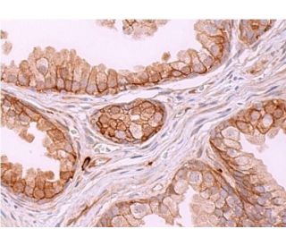 immunohistochemistry image from recommended NDRG1 (B-5) monoclonal antibody replacement. Image 383664