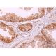 immunohistochemistry image from recommended NDRG1 (B-5) monoclonal antibody replacement. Image 383664