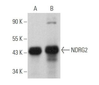 western blotting image from recommended NDRG2 (B-10) monoclonal antibody replacement. Image 369322