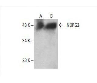 NDRG2 Antibody (E-4) - Western Blotting - Image 393059 