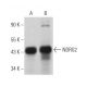 western blotting image from recommended NDRG2 (B-10) monoclonal antibody replacement. Image 369322