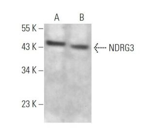 NDRG3 Antibody (H-11) - Western Blotting - Image 373282The Double Nickase Plasmid features a U6 promoter for sgRNA expression, a 20 nt targeting sequence, and a gRNA scaffold to guide Cas9n. It includes a CBh promoter for Cas9n (D10A) and puromycin resistance, GFP for transfection verification, and nuclear localization signals (NLS). The 2A peptide allows co-expression of Cas9n and Puro from a single promoter, enabling precise genome editing with reduced off-target effects.
