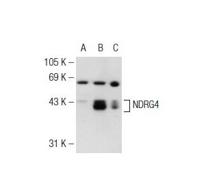 NDRG4 Antibody (39-V) - Western Blotting - Image 126522 