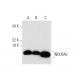 NDUFA5 Antibody (E-5) - Western Blotting - Image 300108 