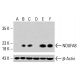 Anticuerpo NDUFA8 (C-6): sc-398097. Análisis por Western blot de la expresión de NDUFA8 en lisados celulares completos de HeLa no tratados (A), HeLa tratados químicamente (B, C), K-562 no tratados (D), K-562 tratados químicamente (E) y HCT-116 (F). β-Actina (C4): sc-47778 utilizada como control de carga. Reactivo de detección utilizado: m-IgG Fc BP-HRP: sc-525409. NDUFA8 Antibody (C-6) - Western Blotting - Image 415367