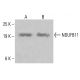 NDUFB11 抗体 (E-2): sc-393394。K-562 (A) および HCT-116 (B) の全細胞溶解液における NDUFB11 の発現のウエスタンブロットによる分析。使用した検出試薬:m-IgG Fc BP-HRP:sc-525409。 NDUFB11 Antibody (E-2) - Western Blotting - Image 415265