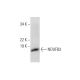 NDUFB3 Antibody (F-11) - Western Blotting - Image 301460