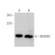 NDUFB3 Antibody (F-11) - Western Blotting - Image 371714 
