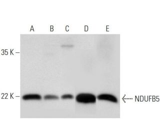 NDUFB5 Antibody (F-2) - Western Blotting - Image 318362 