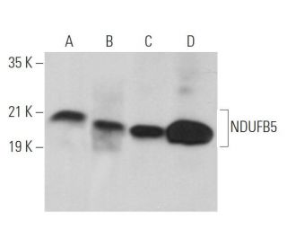 NDUFB5 Antibody (F-2) - Western Blotting - Image 369049The Double Nickase Plasmid features a U6 promoter for sgRNA expression, a 20 nt targeting sequence, and a gRNA scaffold to guide Cas9n. It includes a CBh promoter for Cas9n (D10A) and puromycin resistance, GFP for transfection verification, and nuclear localization signals (NLS). The 2A peptide allows co-expression of Cas9n and Puro from a single promoter, enabling precise genome editing with reduced off-target effects. 