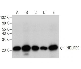 NDUFB9 Antibody (D-7) - Western Blotting - Image 309707 