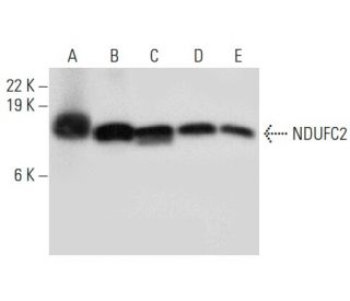 NDUFC2 Antibody (G-9): sc-398719