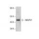 NDUFV1 Antibody (14.8) - Western Blotting - Image 285130 