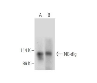 NE-dlg Antibody (A-1) - Western Blotting - Image 333469