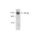 NE-dlg Antibody (B-3) - Western Blotting - Image 326554 