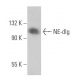 NE-dlg Antibody (B-3) - Western Blotting - Image 366663